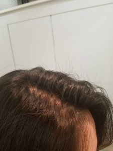 ☆分け方で簡単にトップのボリュームアップ☆