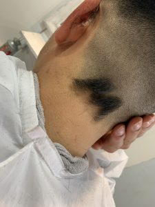 後頭部遊び*